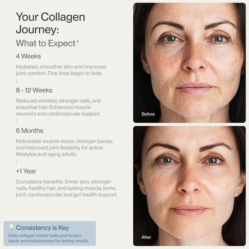 Collagen Peptides Powder Grass-Fed Pasture-Raised Hydrolyzed Collagen Powder, Type I & III Hair, Nails, Skin and Joints, Non-GMO, Paleo & Keto, Unflavored, 16 Fl oz. 45 Servings in Saudi Arabia