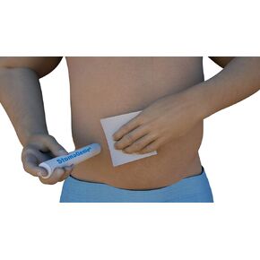 جهاز التقاط نفايات Stoma - 10 عبوات (1 ") ، خرطوشة القبض على Stoma يمكن التخلص منها لأي نوع من فغر اللفائفي ، فغر ، تغيير حقيبة القولون ، حماية الجلد ، والوقاية من التسرب ... in Kuwait