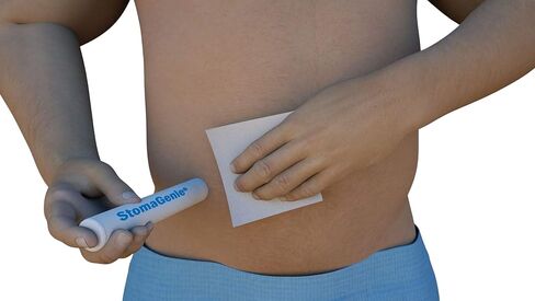 جهاز التقاط نفايات Stoma - 10 عبوات (1 ") ، خرطوشة القبض على Stoma يمكن التخلص منها لأي نوع من فغر اللفائفي ، فغر ، تغيير حقيبة القولون ، حماية الجلد ، والوقاية من التسرب ... in Kuwait