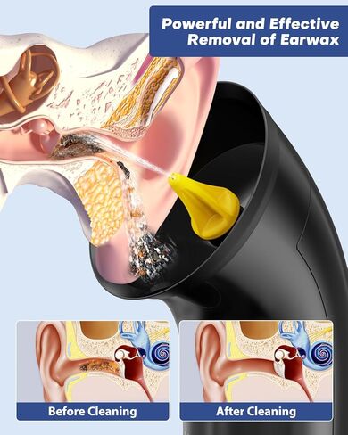 نظافة الأذن الكهربائية التي تمت ترقيتها ، وإزالة شمع الأذن مع تصميم خزان المياه المزدوج 250 مل ، و 4 ضغوط ماء للتنظيف القوي ، و 8 سمات أذن ناعمة ، وشحن USB ، و IPX7 لاتخاذ شمع الأذن الآمن والفعال (الأسود) in Kuwait