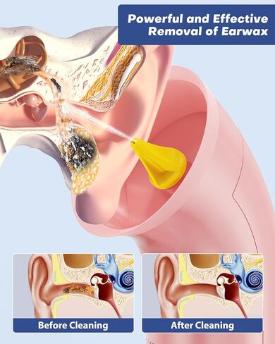 Upgraded Electric Ear Cleaner,Earwax Removal with 250ML Dual Water Tank Design,4 Water Pressures for Powerful Cleaning,8 Soft Earbuds,USB Charging,IPX7 for Safe and Effective Earwax Flushing(Black) in Kuwait