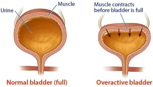 Bladder Regulator, Gosha Jinki Gan. an Effective Herbal Bladder Control for Women & Men. 90 Vegan Capsules. in Saudi Arabia