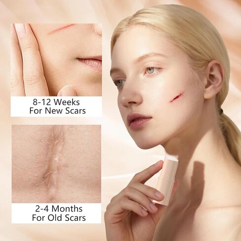 2pcs Silicone Scar Stick, Made of 60% Silicone,Gentle on All Skin Types in Saudi Arabia