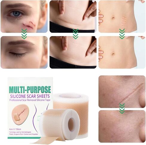 Lejuv Silicone Patches Roll for Face & Neck (1.6" x 120" - 3m) - Reusable & Waterproof Skin Smoothing Tape, Supports Skin Firming, Unisex in Saudi Arabia