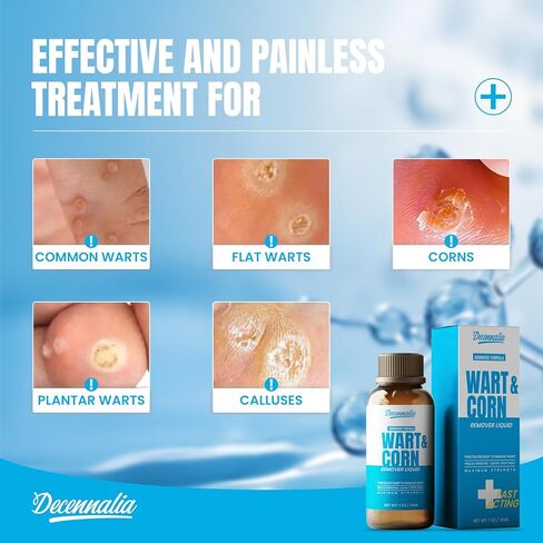 Fast-Acting Wart Corn Remover Freeze Off for Feet, Salicylic Acid Wart Remover for Men Women, Foot Hand Corns Removal for Plantar Genital Common Flat Wart, Callus 1 Oz in Saudi Arabia