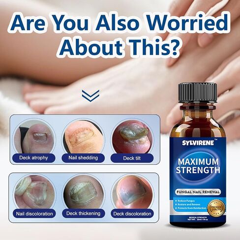 Toenail Fungus Treatment Extra Strength, 30ML Fungus Nail Repair Liquid with 1% Tolnaftate, Fast Acting Treatment for Discolored & Damaged Nails, Athletes Foot in Saudi Arabia