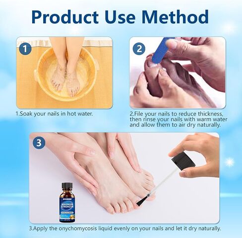 Toenail Fungus Treatment Extra Strength, 30ML Fungus Nail Repair Liquid with 1% Tolnaftate, Fast Acting Treatment for Discolored & Damaged Nails, Athletes Foot in Saudi Arabia