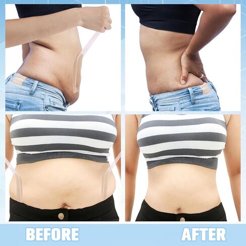 50 PCS TUME TUME PRECUT ALOCYIOLOGY TPU TPU BELLY BELLY TAPERANT PRACHPRAINT FOR WOMEN in Saudi Arabia