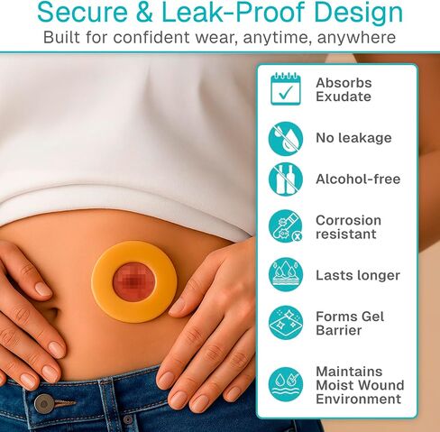 Vive 10 PCS Ostomy Barrier Rings - 3mm Moldable Skin Barrier for Drainable Ostomy Bag - Hydrocolloid Skin Extender Rings - Medical Grade Ostomy Supplies for Colostomy, Ileostomy, Postoperative Care in Kuwait