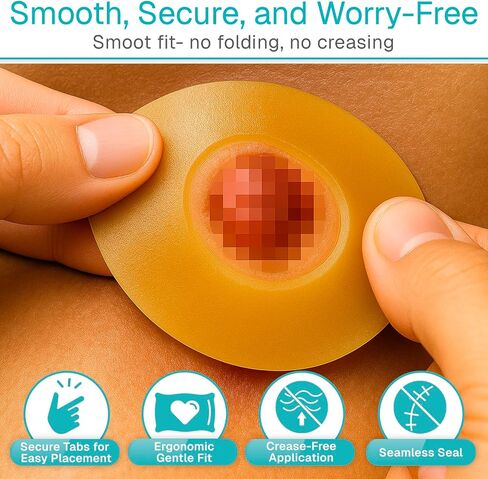 Vive 10 PCS Ostomy Barrier Rings - 3mm Moldable Skin Barrier for Drainable Ostomy Bag - Hydrocolloid Skin Extender Rings - Medical Grade Ostomy Supplies for Colostomy, Ileostomy, Postoperative Care in Kuwait