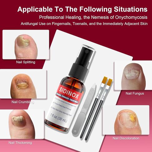 Toenail Fungus Treatment, Treatment Extra Strength with 25% Undecylenic Acid, Fungus Nail Treatment for Damaged Nails, Discolored, Thick Toenails, Help Nail Grow - (1 Fl Oz/30 ml x 5 Pack) in Saudi Arabia