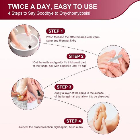 Toenail Fungus Treatment, Treatment Extra Strength with 25% Undecylenic Acid, Fungus Nail Treatment for Damaged Nails, Discolored, Thick Toenails, Help Nail Grow - (1 Fl Oz/30 ml x 5 Pack) in Saudi Arabia