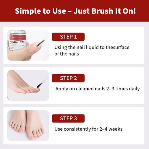 Toenail Fungus Treatment Extra Strength, Nail Fungus Treatment with Undecylenic Acid for Toenail & Fingernails, Antifungal Nail Repair for Athletes Foot, Ingrown, Thick, Broken, Damaged Nail, 30ml in Saudi Arabia