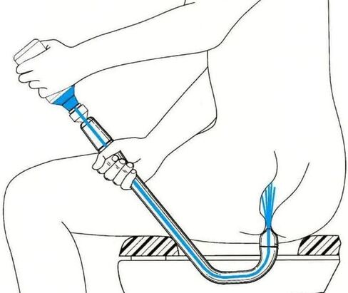 Nippled EZ Enema Kit - Easy, Quick, Comfortable, Mess-Free and Reusable Constipation Relief. Non-Intrusive Design is "Different & Better" than traditional enema bulb, enema bag and enema bucket kits in Saudi Arabia
