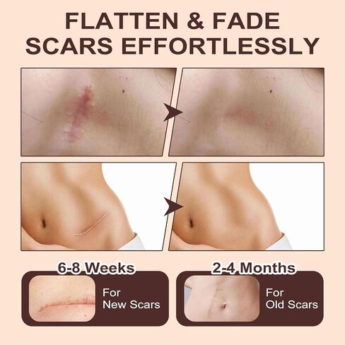 Scar Solutions Silicone Scar Stick,60% Silicone for Face and Body, Stick Applicator Manual Massage Suitable 2PCS in Saudi Arabia