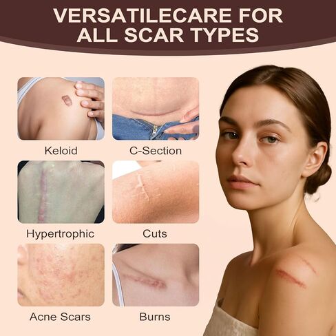 Scar Solutions Silicone Scar Stick,60% Silicone for Face and Body, Stick Applicator Manual Massage Suitable 2PCS in Saudi Arabia