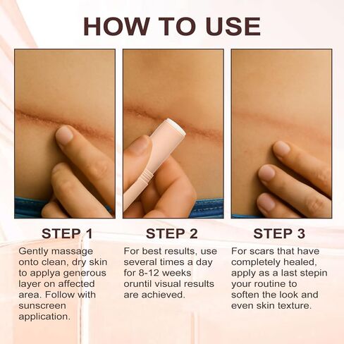 Scar Solutions Silicone Scar Stick,60% Silicone for Face and Body, Stick Applicator Manual Massage Suitable 2PCS in Saudi Arabia