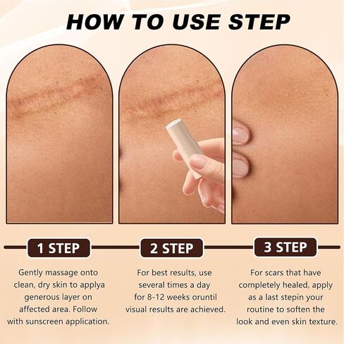 Silicone Scar Stick, 60% Silicone Scar Solutions for Face and Body, Gentle on All Skin Types Easy-to-Use Stick Design, Manual Massage Applicator for Face and Body (2PCS) in Saudi Arabia