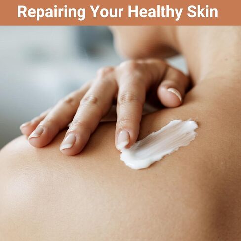 كريمة urticaria لخليط خلايا النحل - يتصرف بسرعة معالجة مضادة لخدوش الجلد ، الاحمرار ، البثور والذمة | صيغة متقدمة in Kuwait