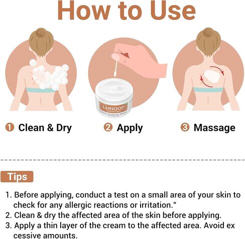 كريمة urticaria لخليط خلايا النحل - يتصرف بسرعة معالجة مضادة لخدوش الجلد ، الاحمرار ، البثور والذمة | صيغة متقدمة in Kuwait