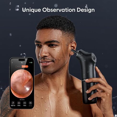 Electric Ear Cleaner with 1080P HD Camera & 4 Modes – Ear Irrigation System, Wireless Otoscope, Safe & Effective Ear Wax Removal, 200ml Water Bottle, for Adults & Kids, Includes 9 Tips, Basin, and Towel in Saudi Arabia