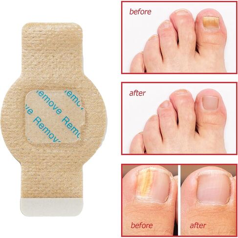 Nail Patches for Toenails, 21pcs/Bag Toenail 8-Hour Overnight Fast Hydrogel Nail Care, Nighttime Nail Repair for Damaged, Discolored Nails, Safe for Sensitive Skin, Easy to Apply (21 PCS) in Kuwait