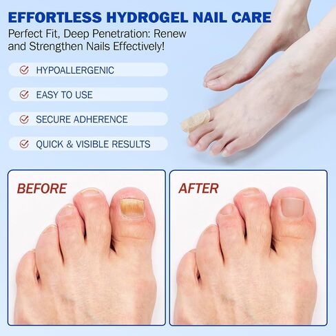 Nail Patches for Toenails, 21pcs/Bag Toenail 8-Hour Overnight Fast Hydrogel Nail Care, Nighttime Nail Repair for Damaged, Discolored Nails, Safe for Sensitive Skin, Easy to Apply (21 PCS) in Kuwait