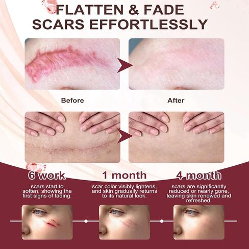 SCAR SOLUTIONS - 3PCS Silicone Scar Stick - For Face and Body, Removal Lip Wrinkles, Skincare Solutions with Centella Asiatica Extracts and Vitamin E, Portable and Soft (3) in Saudi Arabia
