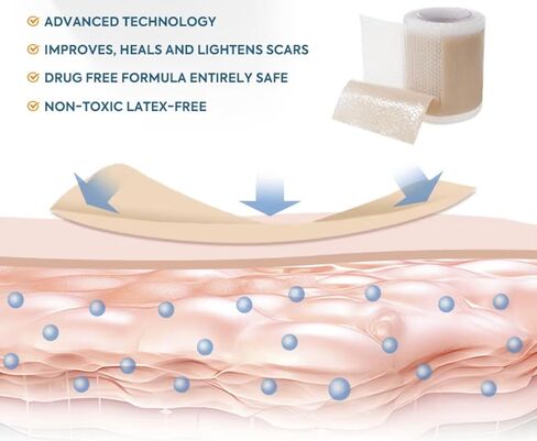 Silicone Scar Sheets 1.6" x 120" - Medical Grade, Long-Lasting, Reusable Tape Roll for C-Section, Surgical Scars, Keloid, Acne, Tummy Tuck Recovery & Wrinkle Treatment in Saudi Arabia