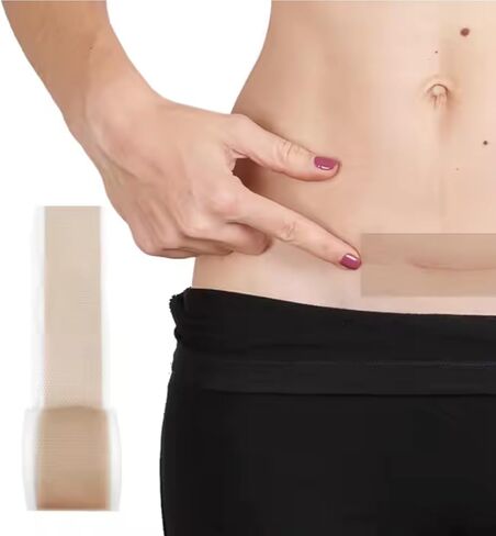 Silicone Scar Sheets 1.6" x 120" - Medical Grade, Long-Lasting, Reusable Tape Roll for C-Section, Surgical Scars, Keloid, Acne, Tummy Tuck Recovery & Wrinkle Treatment in Saudi Arabia