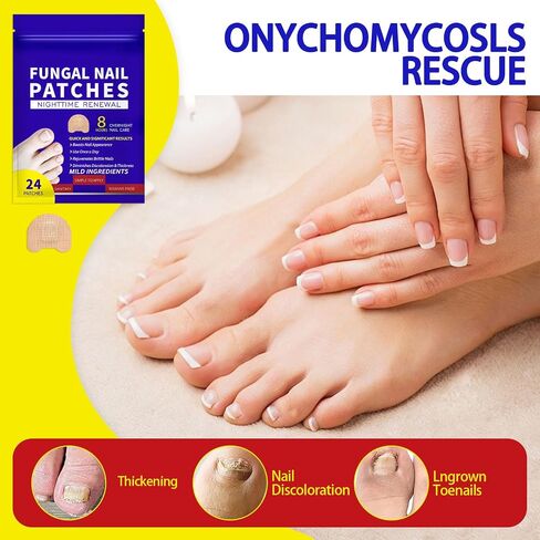 Fungus Nail Patches, Toenail Fungus Treatment Extra Strength for Damaged Discolored Thick Toenails and Fingernails Improves Nail Appearance-24PCS in Saudi Arabia