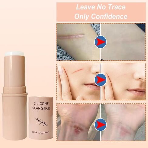 Skin Scar Solutions 60% Silicone Scar Stick, Formula Infused with Centella Asiatica Extracts and Vitamin E, Gentle on All Skin Types in Saudi Arabia