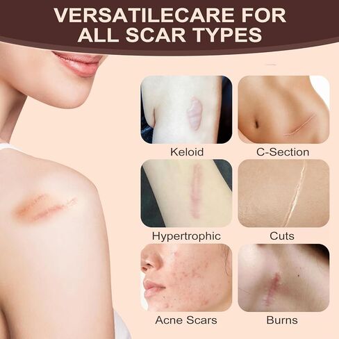 Skin Scar Solutions 60% Silicone Scar Stick, Formula Infused with Centella Asiatica Extracts and Vitamin E, Gentle on All Skin Types in Saudi Arabia