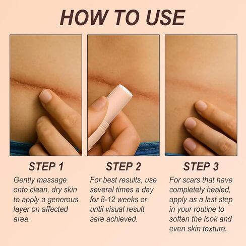Skin Scar Solutions 60% Silicone Scar Stick, Formula Infused with Centella Asiatica Extracts and Vitamin E, Gentle on All Skin Types in Saudi Arabia