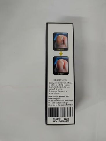 Fungal Nail Treatment in Kuwait