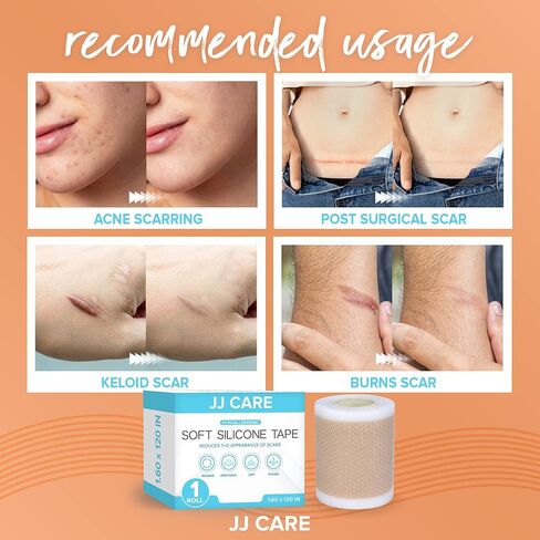 شريط سيليكون ناعم من JJ CARE، شريط ندبات سيليكون مرن مقاس 1.6 بوصة × 120 بوصة، شرائط سيليكون طبية للندبات، شريط ندبات قابل للغسل وإعادة الاستخدام للندبات الجراحية، شريط ندبات خالٍ من اللاتكس in Saudi Arabia