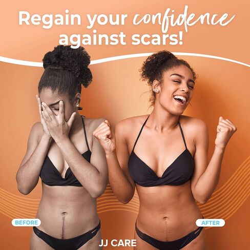 شريط سيليكون ناعم من JJ CARE، شريط ندبات سيليكون مرن مقاس 1.6 بوصة × 120 بوصة، شرائط سيليكون طبية للندبات، شريط ندبات قابل للغسل وإعادة الاستخدام للندبات الجراحية، شريط ندبات خالٍ من اللاتكس in Saudi Arabia