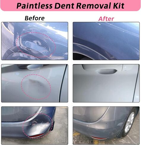 VEXTRO Dent Puller Kit, Paintless Dent Repair Tools with Dent Lifter, Bridge Puller, Slide Hammer T-Bar, PDR Car Dent Removal Kit with Glue Gun and Tabs for Auto Body Hail Damage in Saudi Arabia