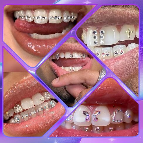Tooth Gem Kit, DIY Crystals Jewelry Kit Teeth Gems Kit, Professional Fashionable Tooth Gems Kit for Teeth, Teeth Jewelry Starter kit in Saudi Arabia