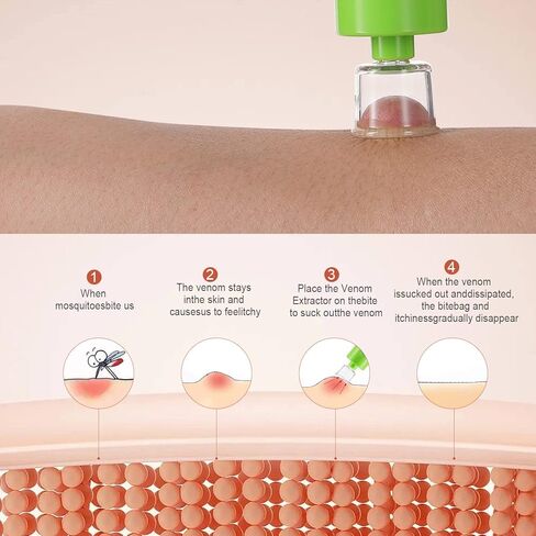 أداة شفط لتخفيف اللدغات، مضخة شفط مستخرج السم، مجموعة لدغات الثعبان، مجموعات النجاة، إسعافات أولية للعض واللسع لإزالة السموم للمشي لمسافات طويلة وحقائب الظهر والتخييم، خالية من المواد الكيميائية (أخضر) in Kuwait