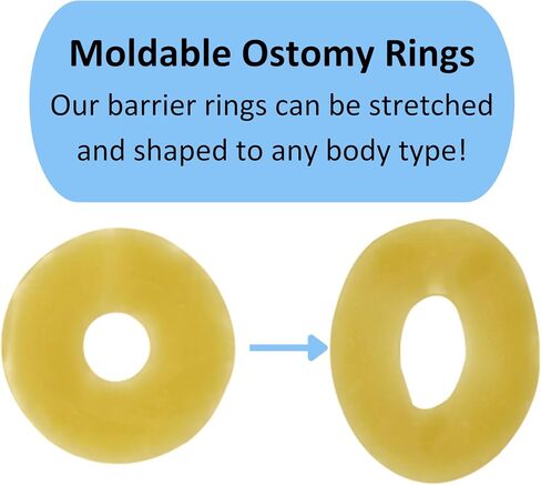 Elastic Moldable Ostomy Barrier Rings- Outer Diameter 2" (48mm) 4mm Thickness -Ostomy Supplies Non-Leaking Seal for Stoma, Sting-Free Hydrocolloid Skin Barrier Extender Ring for Colostomy Bags, 10PCS in Kuwait