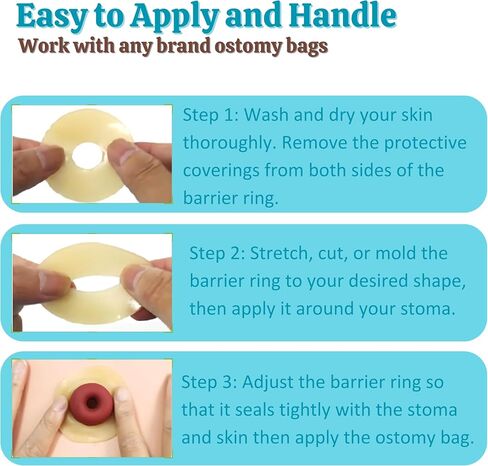 Elastic Moldable Ostomy Barrier Rings- Outer Diameter 2" (48mm) 4mm Thickness -Ostomy Supplies Non-Leaking Seal for Stoma, Sting-Free Hydrocolloid Skin Barrier Extender Ring for Colostomy Bags, 10PCS in Kuwait