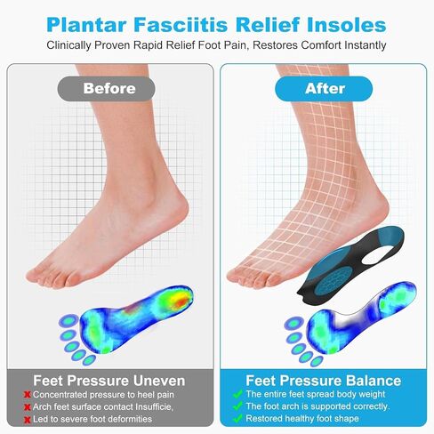 Plantar Fasciitis Relief Arch Support Inserts Flat Feet Orthotics 3/4 Length Thin Shoe Inserts Women Men for Foot Pain Relief, X/O Legs Correction Comfy Foot Care in Saudi Arabia