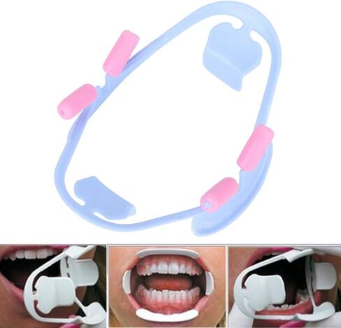 3D Mouth Opener, Dental Cheek Retractor, 2 Sizes 3D Mouth Opener Dental Intraoral Cheek Retractor Oral Teeth Dentist Tools (Blue) in Saudi Arabia