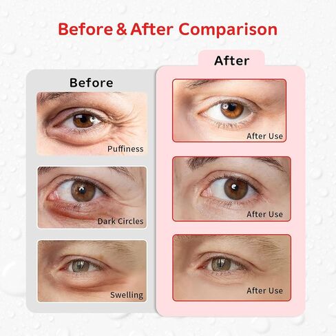 4PCS Gel Eye Ice Pack Set Reusable, Cold and Hot Compress for Eyes, Ice Pack for Eyes, Cooling Eye Pads for Eye Strain, Swelling, Redness, Dark Circles, Puffy Eyes, and Eye Recovery Surgery. in Kuwait