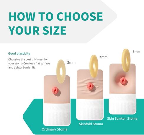 10Pcs Thick Ostomy Barrier Rings, 4mm Moldable Ostomy Rings, Hydrocolloid Skin Extender Rings for Colostomy Bags,Sting-Free Ostomy Supplies in Kuwait