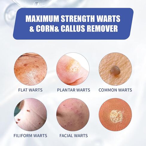 Likluc Fast-Acting Wart Remover Gel with Freeze Off Technology - Genital, Common Warts & Plantar wart Remover for Feet, Skin & More in Kuwait