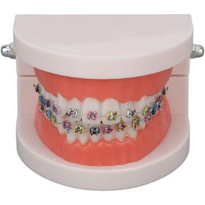 Teeth Model, Dental Teeth Models Kids Dental Teaching Study Supplies with Metal Bracket Dental Treatment Teeth Model for Dentist Research Dental Laboratory Fake Teeth Braces