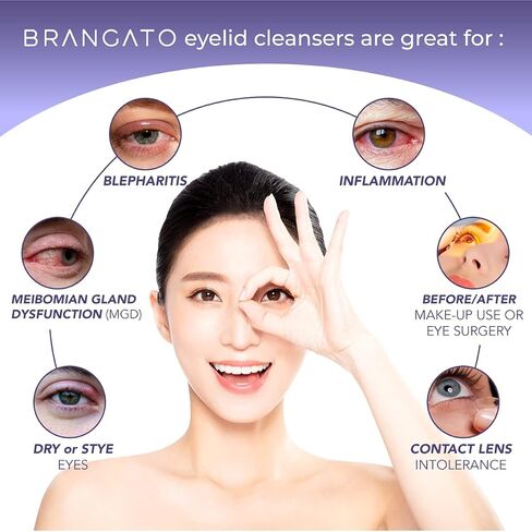 Eyelid and Lash Cleanser - Dry Eye Relief, Stye and Blepharitis Treatments, FDA-Cleared Hypochlorous Acid Spray, 60mL(2oz) in Saudi Arabia