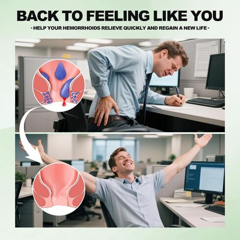 Hemorrhoid and Fissure Cream,Hemorrhoidal Ointment for Fast Acting Itch, Swelling, and Maximum Strength Pain Relief（1 Pack in Kuwait